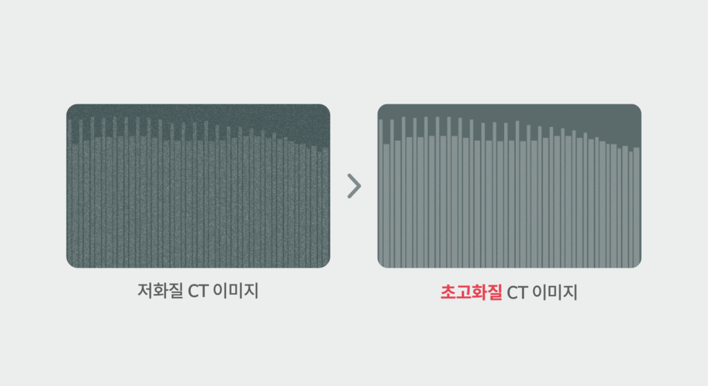 슈퍼 레졸루션 AI 기술로 저화질 이미지를 고화질로 변환하여 2차전지 내부 젤리롤 상태를 정밀 검사